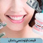قیمت ارتودنسی دندان