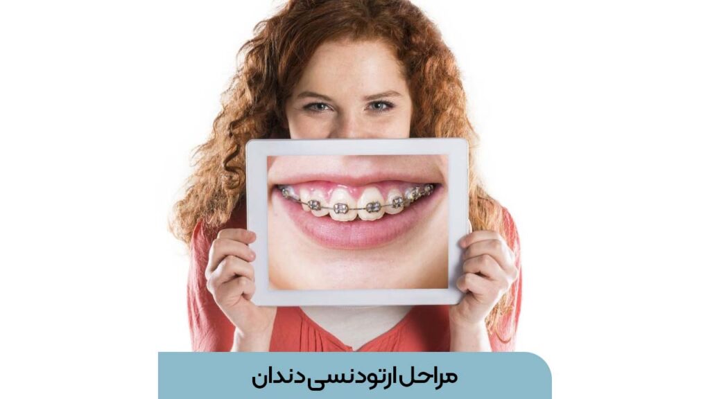 مراحل ارتودنسی دندان
