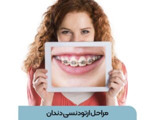 مراحل ارتودنسی دندان