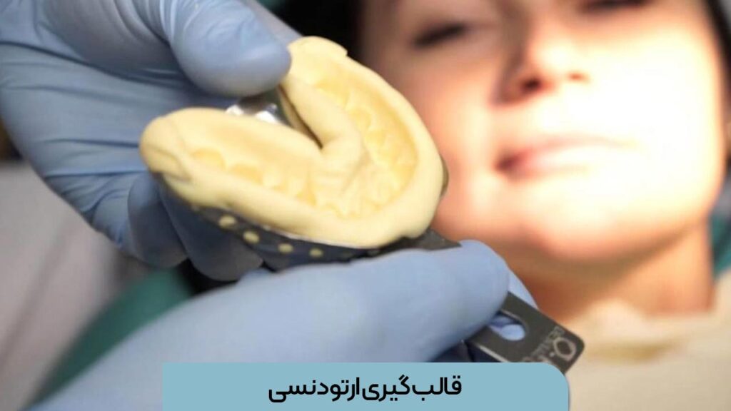 قالب گیری ارتودنسی