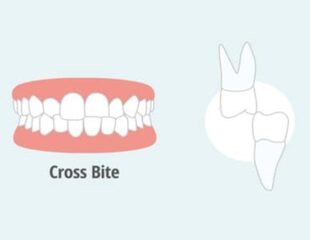 کراس بایت
